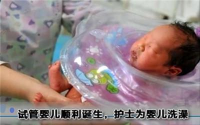卵巢评估